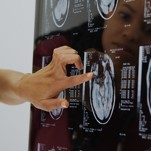 Traumatic Brain Injuries